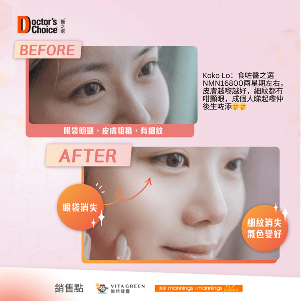 {e7f7f967-78fa-4032-be73-54c1a621b862}_Koko_Lo_Image